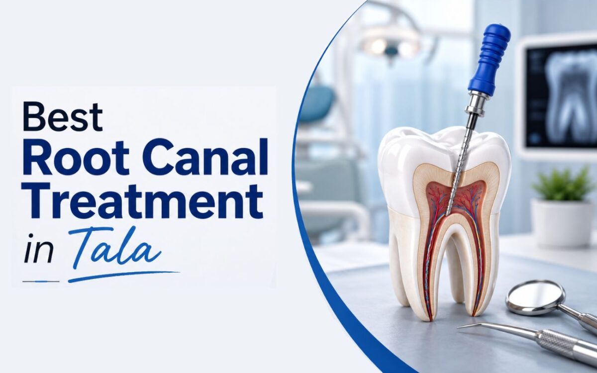 Root Canal Treatment in Tala