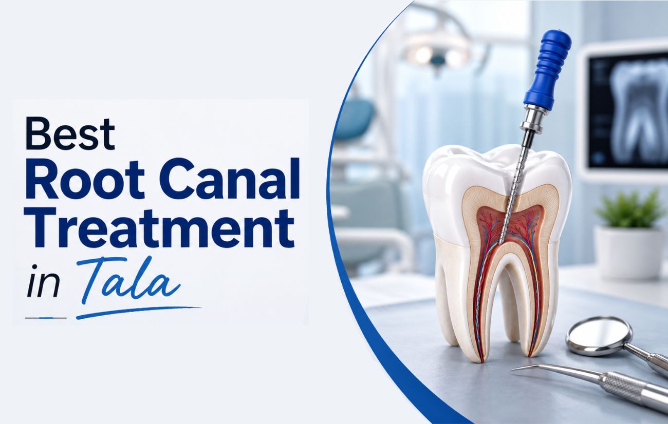 Root Canal Treatment in Tala